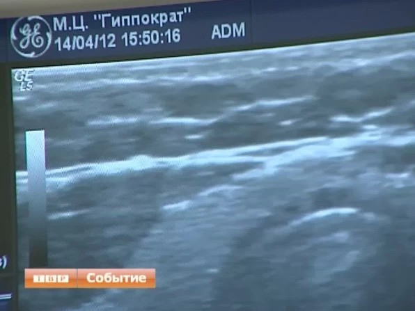 Коммерческие новости