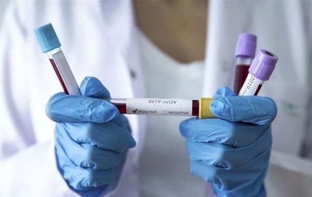 В Подмосковье выявлено 67 новых случаев коронавирусной инфекции