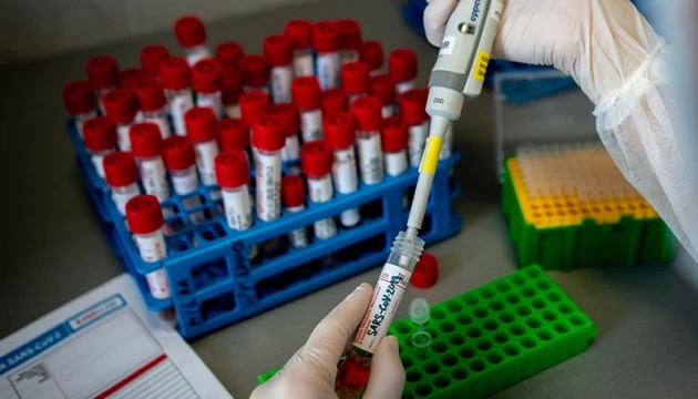 В Подмосковье выявлено 460 новых случаев COVID-19