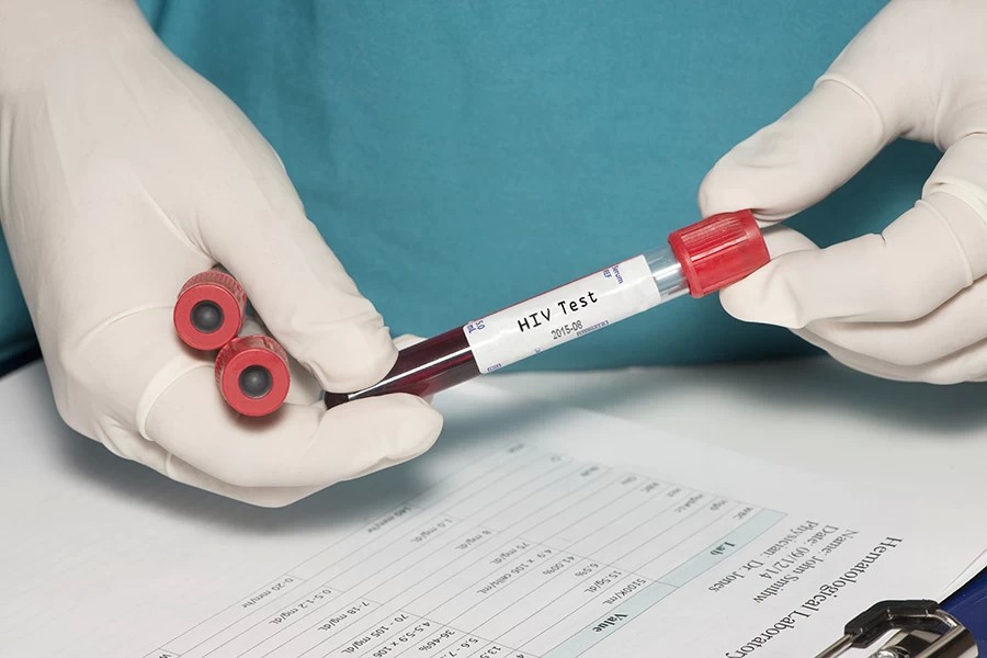 Исследование на ВИЧ-инфекцию прошли почти 25 тысяч сергиевопосадцев
