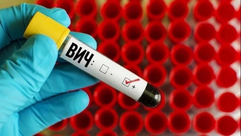 Порядка 25 тысяч жителей Сергиево-Посадского округа прошли обследование на ВИЧ