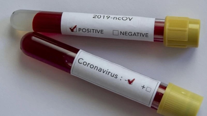 Сергиев Посад - среди антилидеров по Covid-19