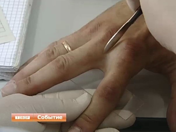 Медики призывают уделять особое внимание личной гигиене